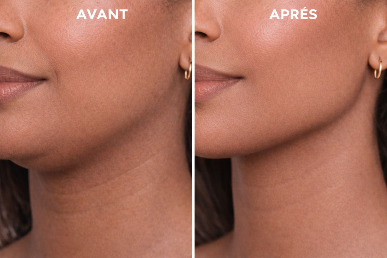 Jawline/ La Mâchoire